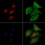 RAD21 Antibody in Immunocytochemistry (ICC/IF)