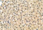 RAD21 Antibody in Immunohistochemistry (Paraffin) (IHC (P))