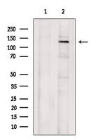 RAD21 Antibody in Western Blot (WB)