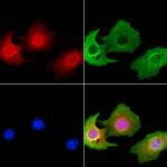 ASH2L Antibody in Immunocytochemistry (ICC/IF)