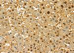 ASH2L Antibody in Immunohistochemistry (Paraffin) (IHC (P))