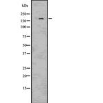 IRS2 Antibody in Western Blot (WB)