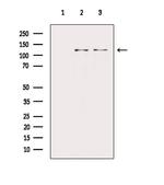 Phospho-PERK (Thr982) Antibody in Western Blot (WB)