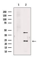 RAB10 Antibody in Western Blot (WB)