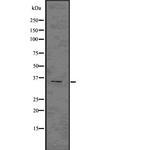 NKp46 Antibody in Western Blot (WB)