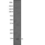 ASIP Antibody in Western Blot (WB)