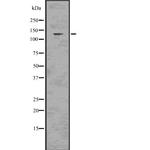 CARD11 Antibody in Western Blot (WB)