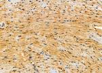 INSRR Antibody in Immunohistochemistry (Paraffin) (IHC (P))