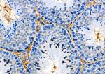 INSRR Antibody in Immunohistochemistry (Paraffin) (IHC (P))