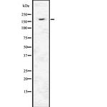 INSRR Antibody in Western Blot (WB)