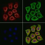 ARPC5 Antibody in Immunocytochemistry (ICC/IF)