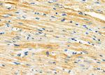 ARPC5 Antibody in Immunohistochemistry (Paraffin) (IHC (P))