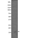 ARPC5 Antibody in Western Blot (WB)