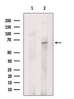 SLC27A1 Antibody in Western Blot (WB)