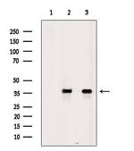 Aquaporin 7 Antibody in Western Blot (WB)