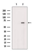 UGT2B17 Antibody in Western Blot (WB)