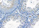 Cathelicidin Antibody in Immunohistochemistry (Paraffin) (IHC (P))