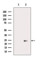 Cathelicidin Antibody in Western Blot (WB)