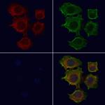 CENPE Antibody in Immunocytochemistry (ICC/IF)