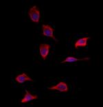 SOD3 Antibody in Immunocytochemistry (ICC/IF)