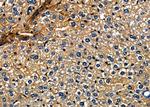 FGF3 Antibody in Immunohistochemistry (Paraffin) (IHC (P))