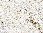 Phospho-PKM2 (Ser37) Antibody in Immunohistochemistry (Paraffin) (IHC (P))