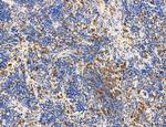 Phospho-PKM2 (Ser37) Antibody in Immunohistochemistry (Paraffin) (IHC (P))