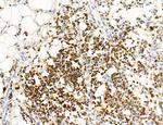 Phospho-PKM2 (Ser37) Antibody in Immunohistochemistry (Paraffin) (IHC (P))