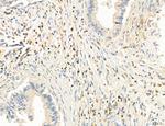 Phospho-PKM2 (Ser37) Antibody in Immunohistochemistry (Paraffin) (IHC (P))