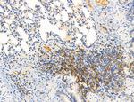 Phospho-PKM2 (Ser37) Antibody in Immunohistochemistry (Paraffin) (IHC (P))