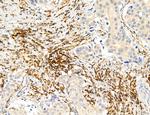 Phospho-PKM2 (Ser37) Antibody in Immunohistochemistry (Paraffin) (IHC (P))