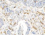 Phospho-PKM2 (Ser37) Antibody in Immunohistochemistry (Paraffin) (IHC (P))