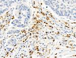 Phospho-PKM2 (Ser37) Antibody in Immunohistochemistry (Paraffin) (IHC (P))