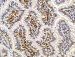 Phospho-PKM2 (Ser37) Antibody in Immunohistochemistry (Paraffin) (IHC (P))