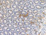 Phospho-PKM2 (Ser37) Antibody in Immunohistochemistry (Paraffin) (IHC (P))