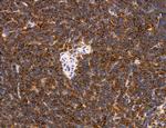 Phospho-PKM2 (Ser37) Antibody in Immunohistochemistry (Paraffin) (IHC (P))