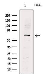 Phospho-PKM2 (Ser37) Antibody in Western Blot (WB)