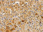 DAB2 Antibody in Immunohistochemistry (Paraffin) (IHC (P))