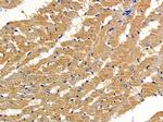 DAB2 Antibody in Immunohistochemistry (Paraffin) (IHC (P))