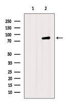 DAB2 Antibody in Western Blot (WB)