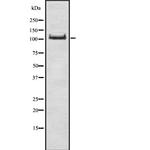 ADAP Antibody in Western Blot (WB)