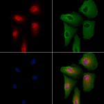 REST Antibody in Immunocytochemistry (ICC/IF)