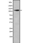 REST Antibody in Western Blot (WB)