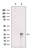 C1QA Antibody in Western Blot (WB)