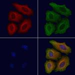 C1QA Antibody in Immunocytochemistry (ICC/IF)