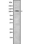 PSMA Antibody in Western Blot (WB)