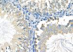 AP2S1 Antibody in Immunohistochemistry (Paraffin) (IHC (P))