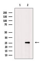 Hemoglobin Antibody in Western Blot (WB)