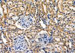 PUM1 Antibody in Immunohistochemistry (Paraffin) (IHC (P))