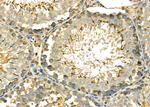 PUM1 Antibody in Immunohistochemistry (Paraffin) (IHC (P))